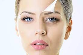 چگونه از تیرگی پشت پلک خلاص شویم؟